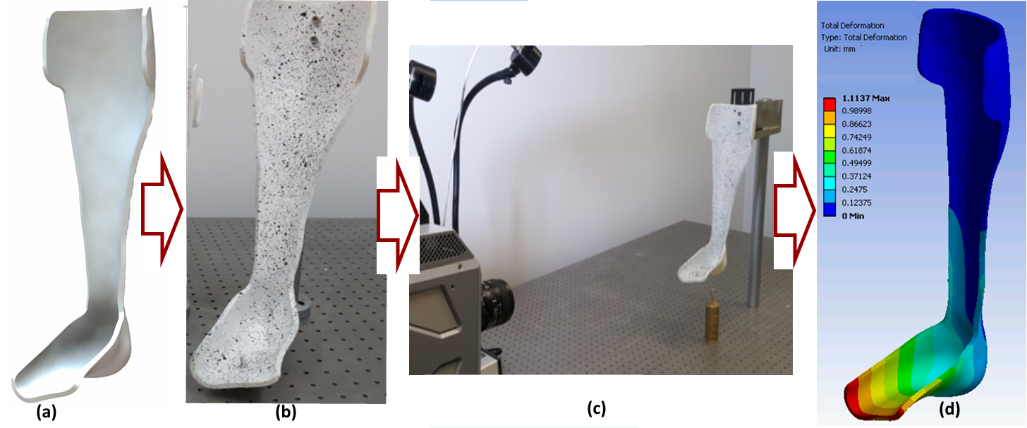 Ankle Foot Orthotics 